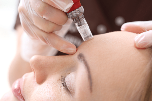 2.VENTAJAS MESOTERAPIA